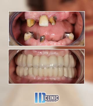 Slider image (2) IDC International Dental Clinic